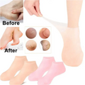 Moisturizing Silicone Socks/Gloves - 1 Pair